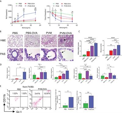 Proline metabolism reprogramming of trained macrophages induced by early respiratory infection combined with allergen sensitization contributes to development of allergic asthma in childhood of mice